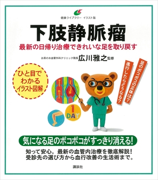 下肢静脈瘤　最新の日帰り治療できれいな足を取り戻す