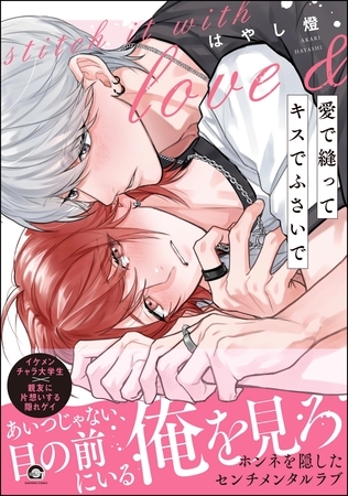 【期間限定　試し読み増量版】愛で縫ってキスでふさいで【電子限定かきおろし漫画2P付】